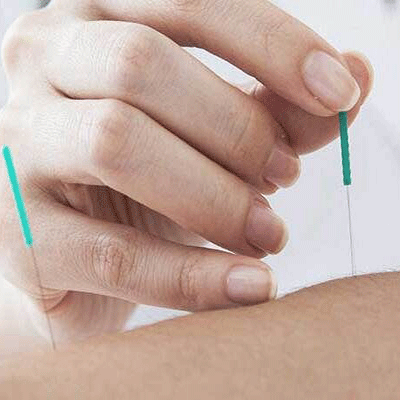 Best Acupuncture Therapy in Navi Mumbai by Dr. Kalpesh Mande